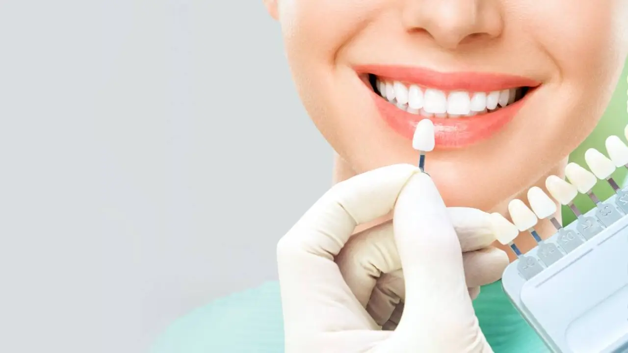 Teeth Whitening In Vadodara