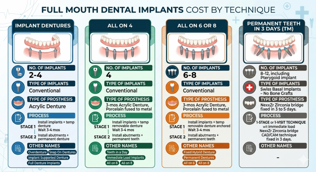 Full mouth Dental Implant in Vadodara
