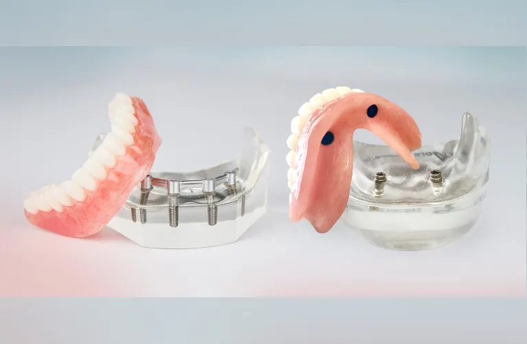 denture on implant