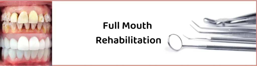 full mouth rehabilitation