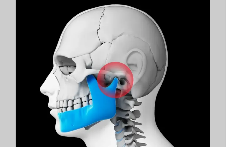 tmj dentist in vadodara