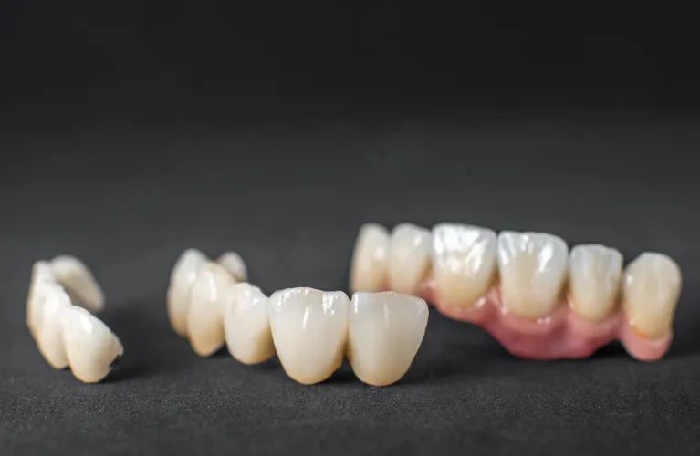 zirconia crown in vadodara