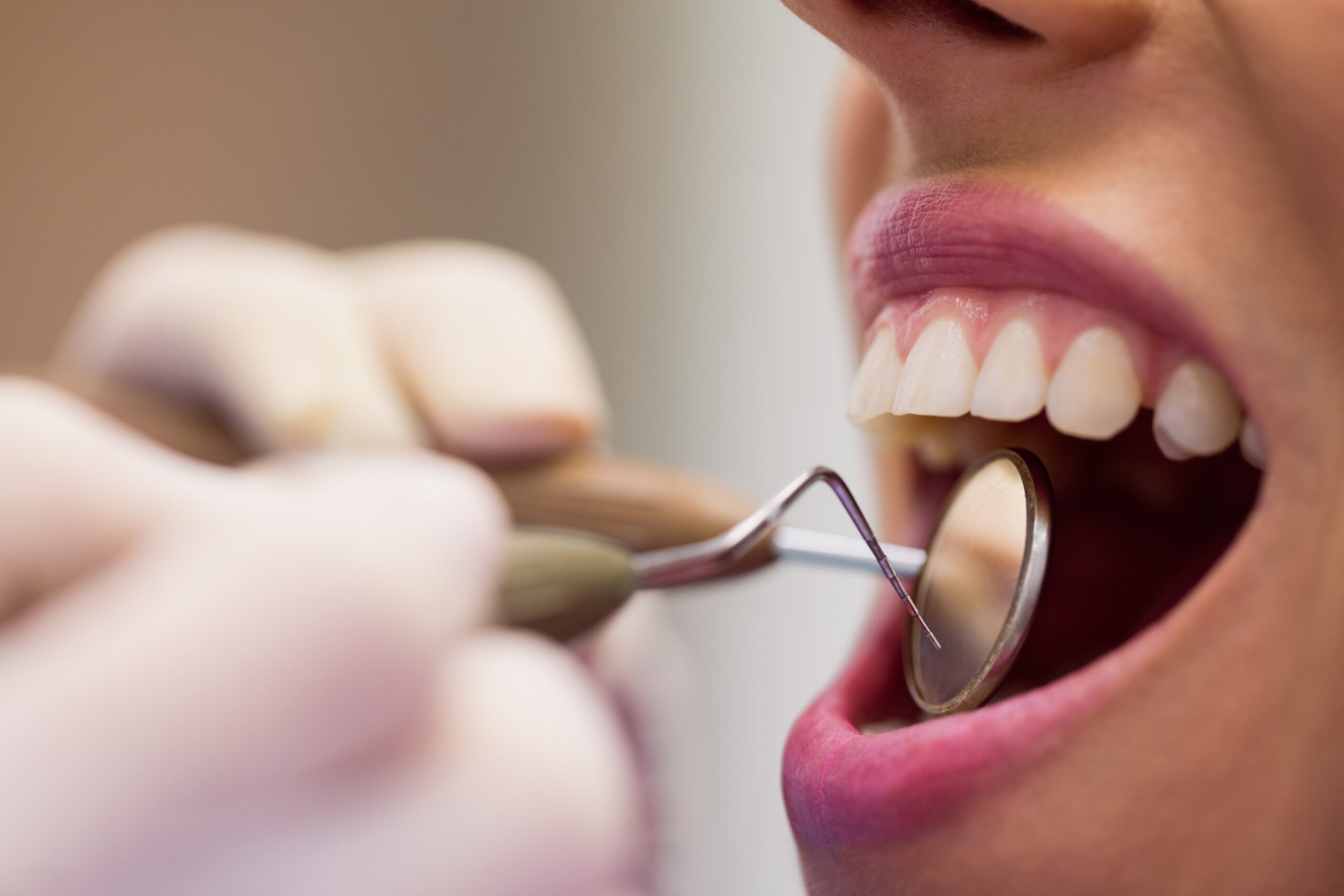 Best Dental Clinic IN Bhayli , Vadodara