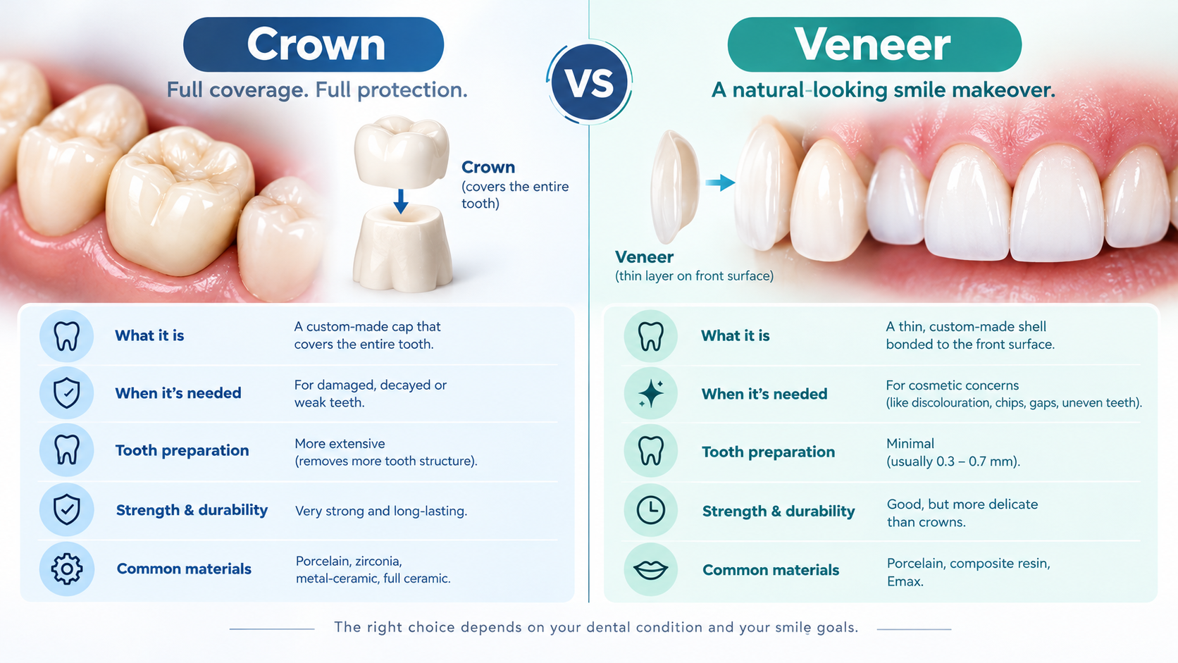 Crowns vs Veneers for Smile Design: Which Is Better?